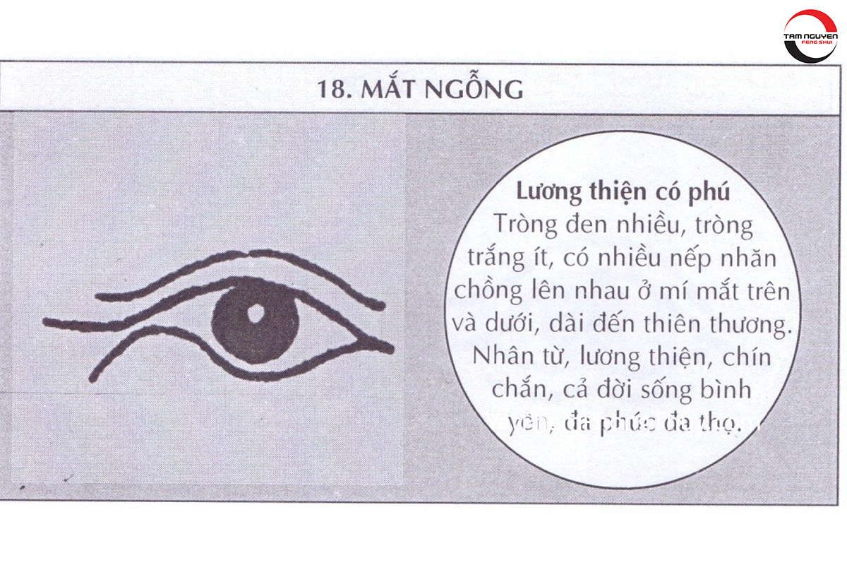 các loại mắt người