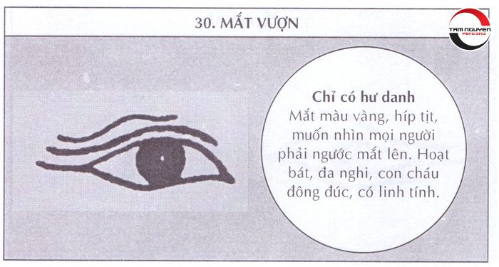các loại mắt