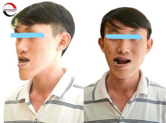 xem tướng mặt